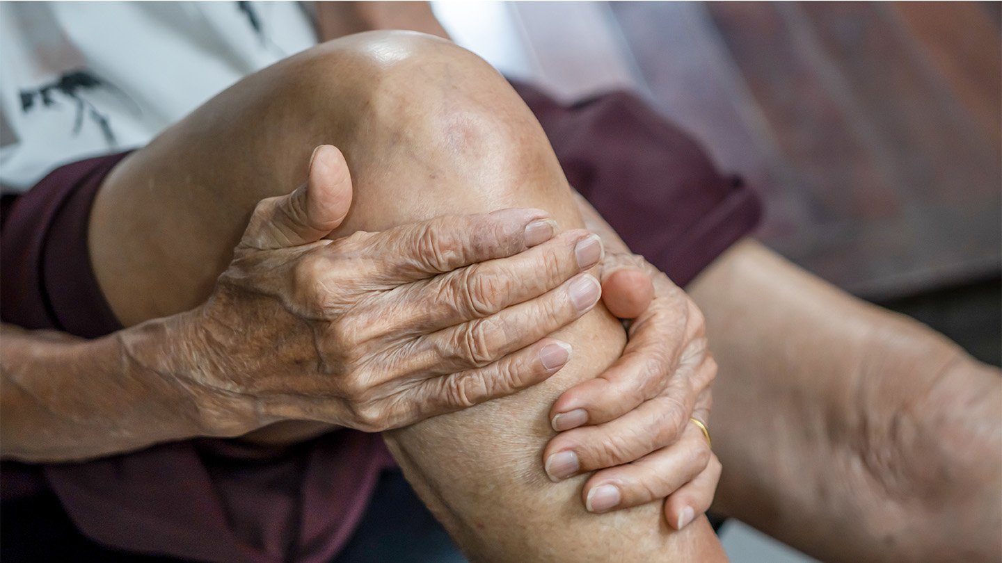 People with osteoarthritis, a degenerative joint disease, can experience pain and loss of cartila...