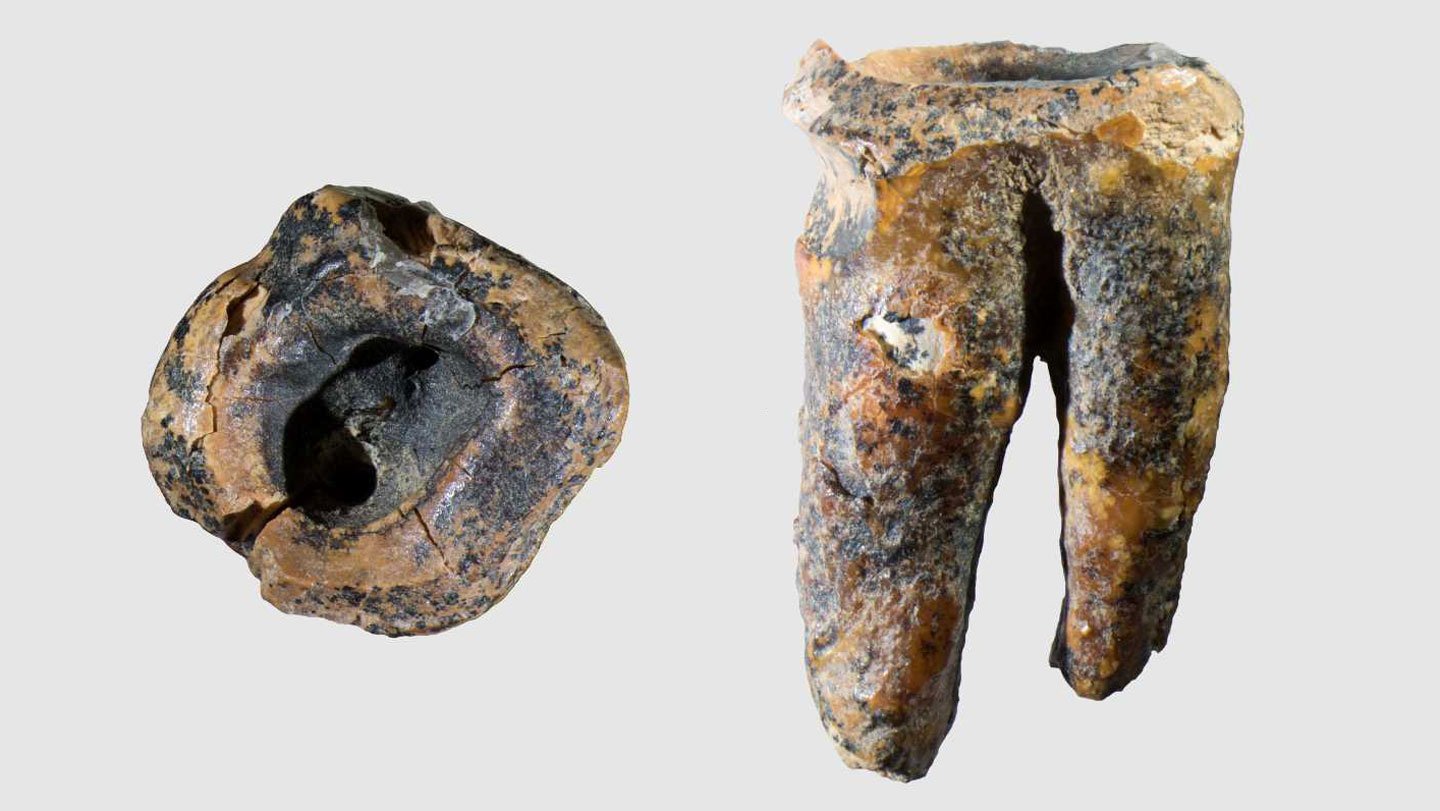 The ancient molar was found in the Chagyrskaya Cave in Siberia. It has been drilled out by a ston...