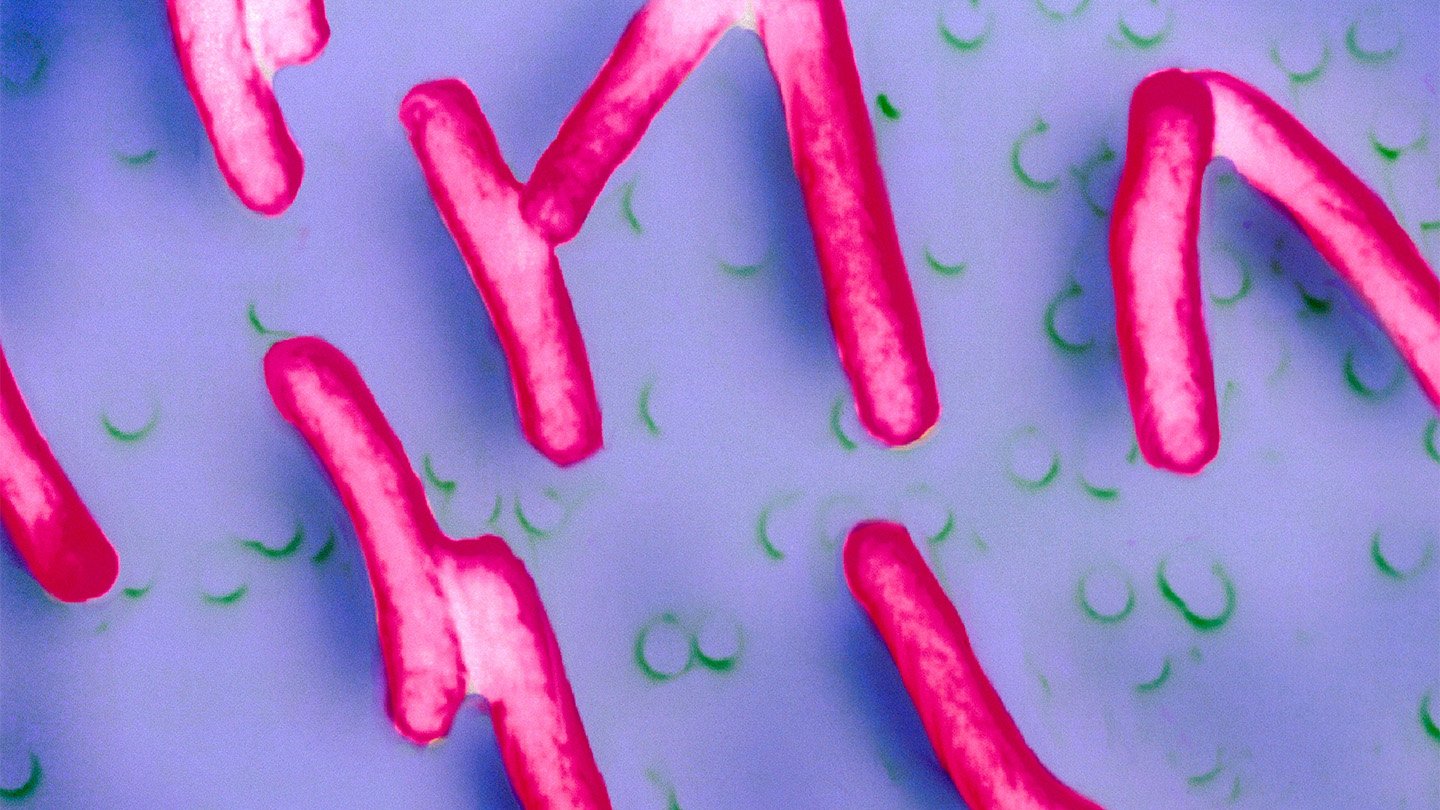 Shigella sonnei bacteria (illustrated) are the dominant cause of shigellosis infections in the Un...