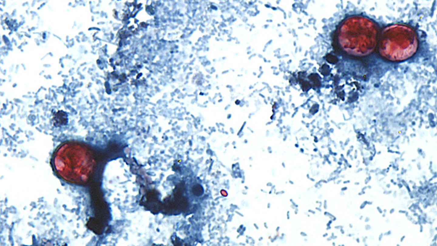 The foodborne parasite Cyclospora cayetanensis (stained red in this micrograph of a human stool s...