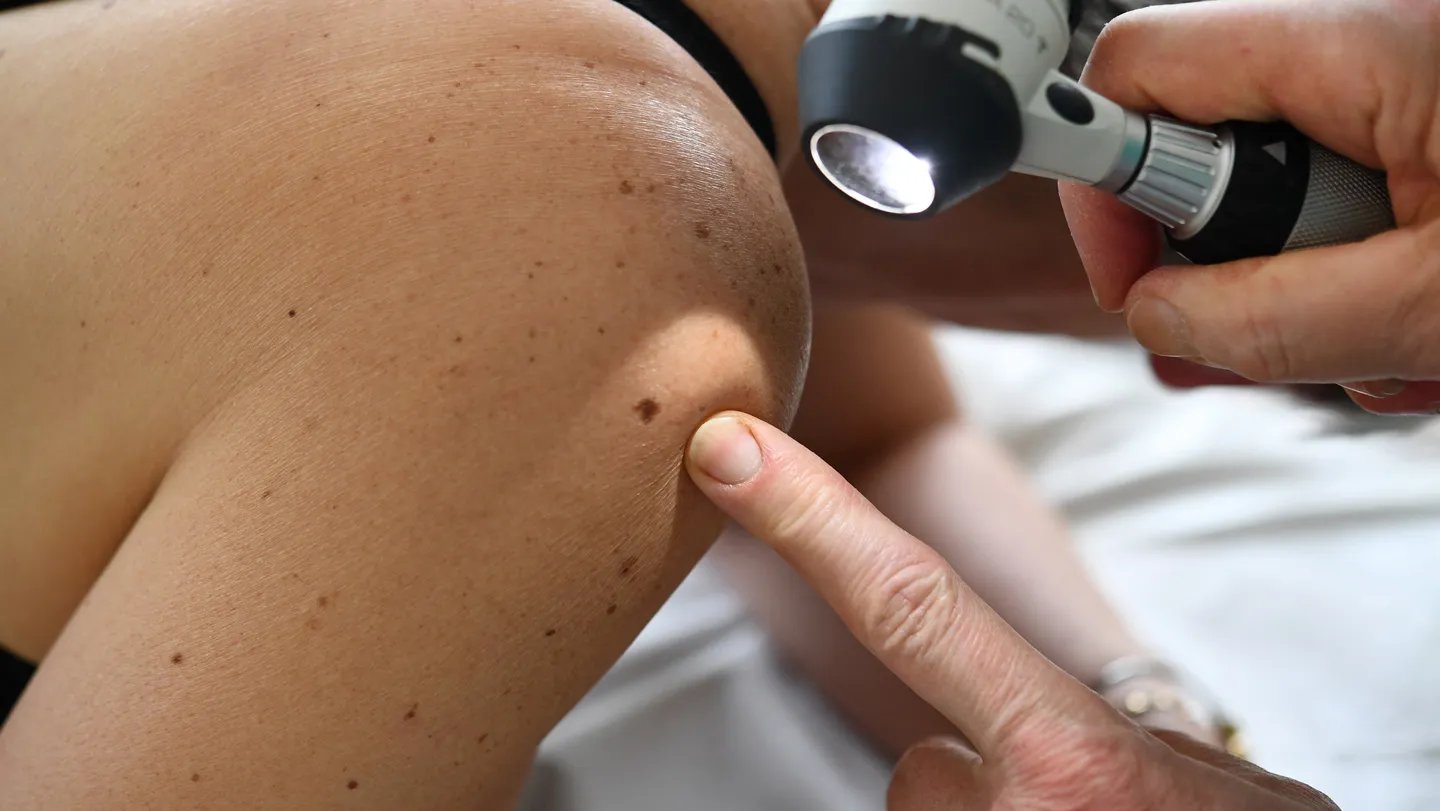 A cancer vaccine candidate shows promise in clinical trials, according to pharmaceutical companie...