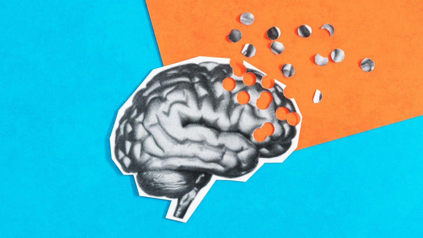 APOE4 raises Alzheimer’s risk, but how it makes the brain vulnerable to disease remains unclear...