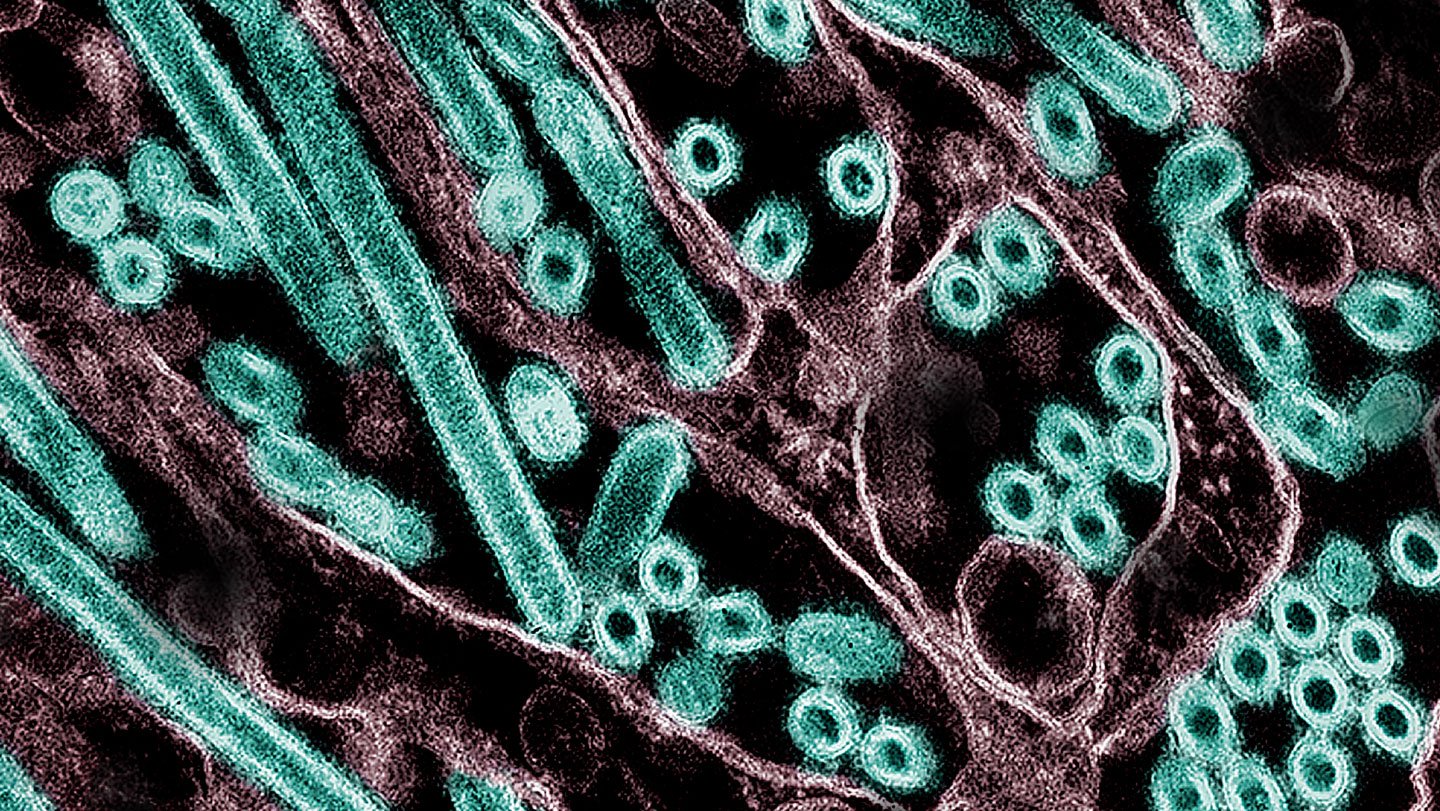 H5N1 avian influenza virus particles (green) grow in kidney cells (purple). Anthropic’s Claude ...