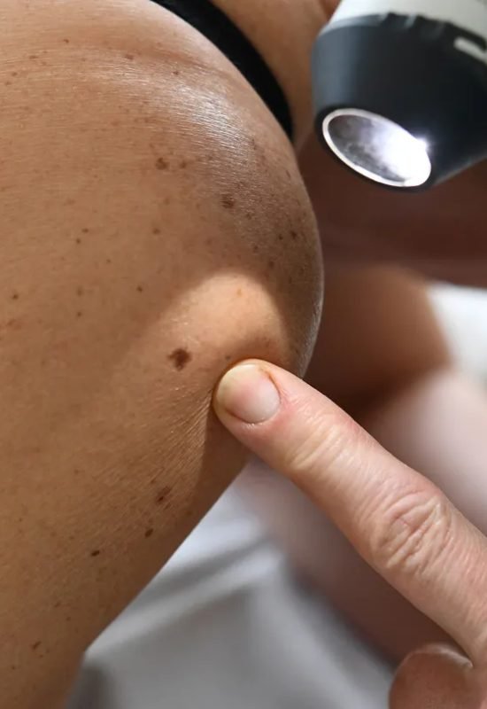 A cancer vaccine candidate shows promise in clinical trials, according to pharmaceutical companie...